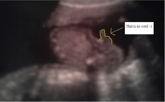 Ultrasounds Of Boys. of your oy#39;s quot;partsquot; hehe
