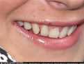 Lindsay Lohan has a great smile