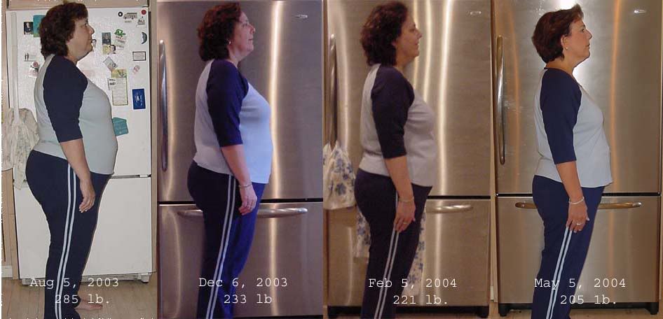 0, 4, 6 and 9 months post-op - profile