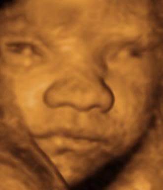 3d ultrasound pictures. Black And White 3d Ultrasound.