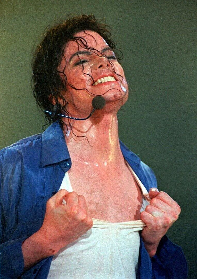 Hauterkrankung Vitiligo bei Michael Jackson