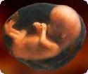 8 week unborn